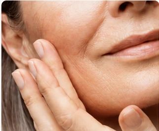 Longevity — a woman resting a hand against her cheek